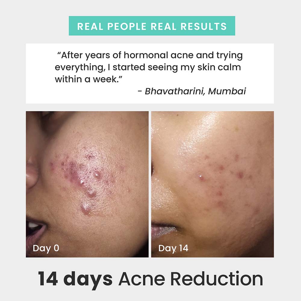 Rapid Clear Face Wash
