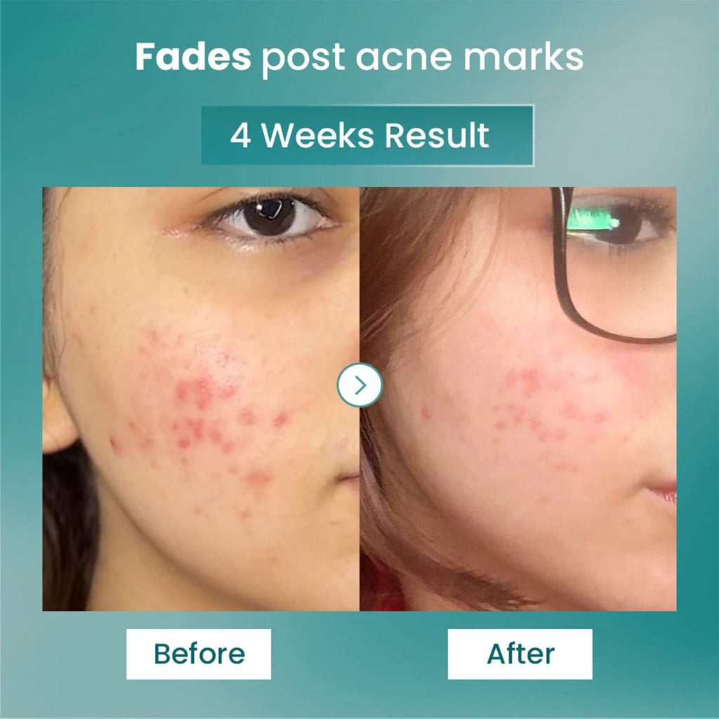 Spot Fade Advance Repair Serum