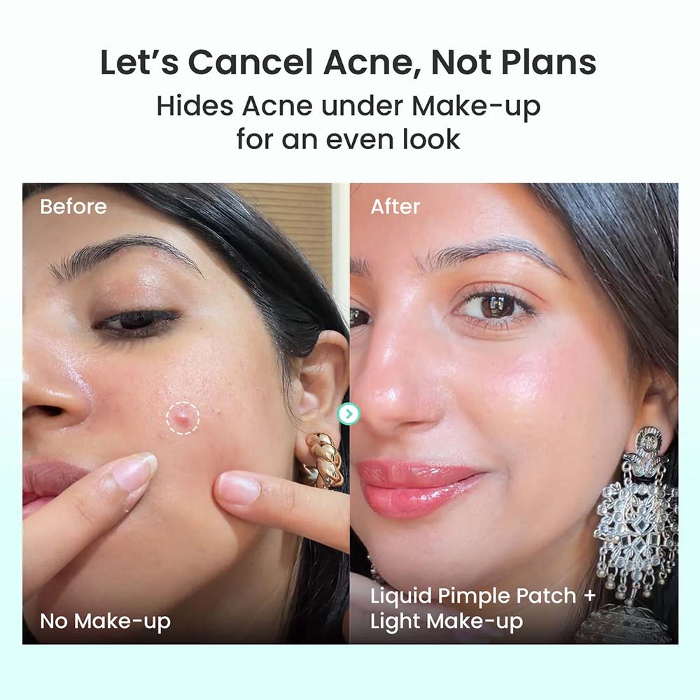 Liquid Pimple Patch