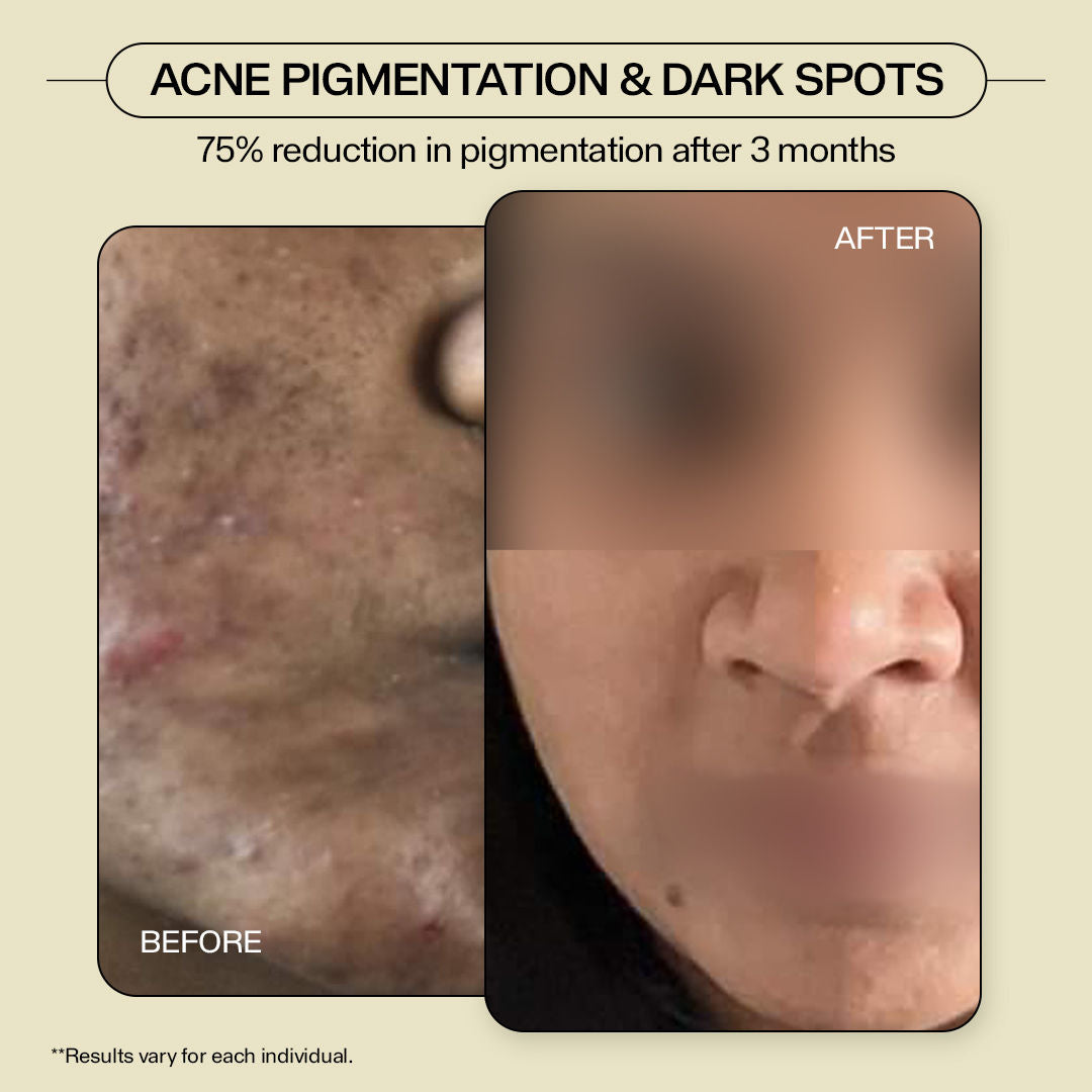 3 in 1 Skin Hydrator (Toner + Serum + Moisturizer) 1.4% Ceramides