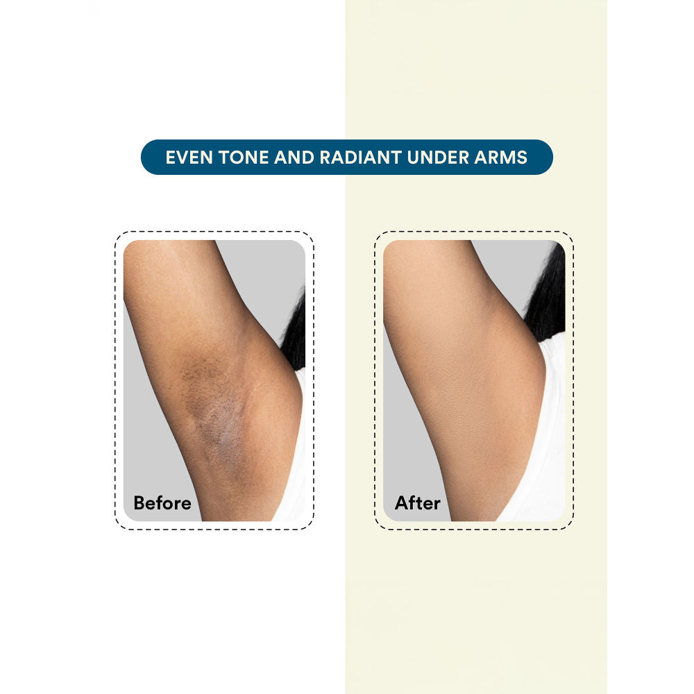 Bloom Hair Removal Cream No Skin Darkening With Spatula Orange Fragrance