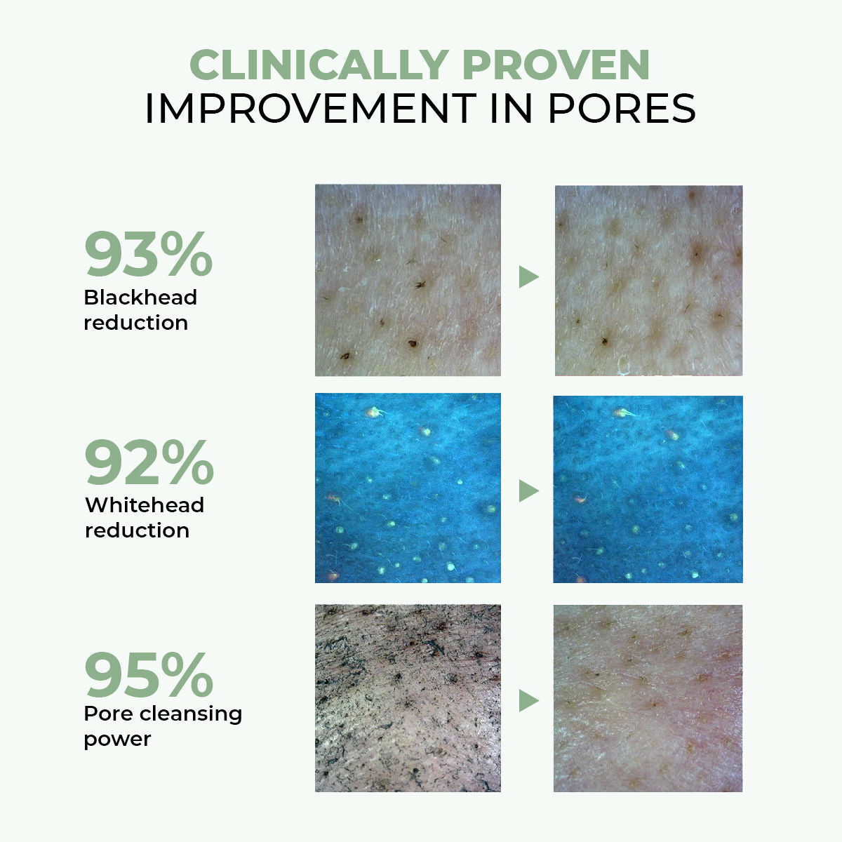 Zero Pore Ultra Light Oil Cleanser