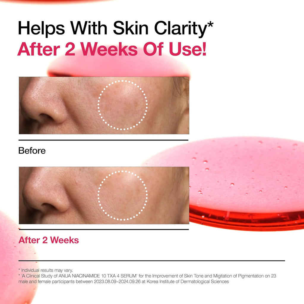 Niacinamide 10 Txa 4 Serum, Brightening Korean Serum For Dark Spots & Hyperpigmentation