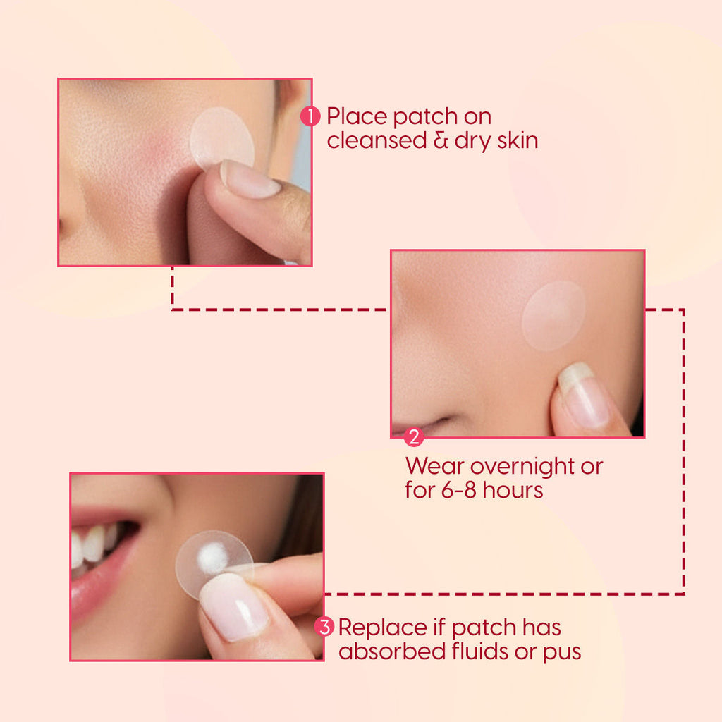 Acne Pimple Patches with Hydrocolloid - Face Spot Corrector Tape to Heal Acne, Prevent Scars