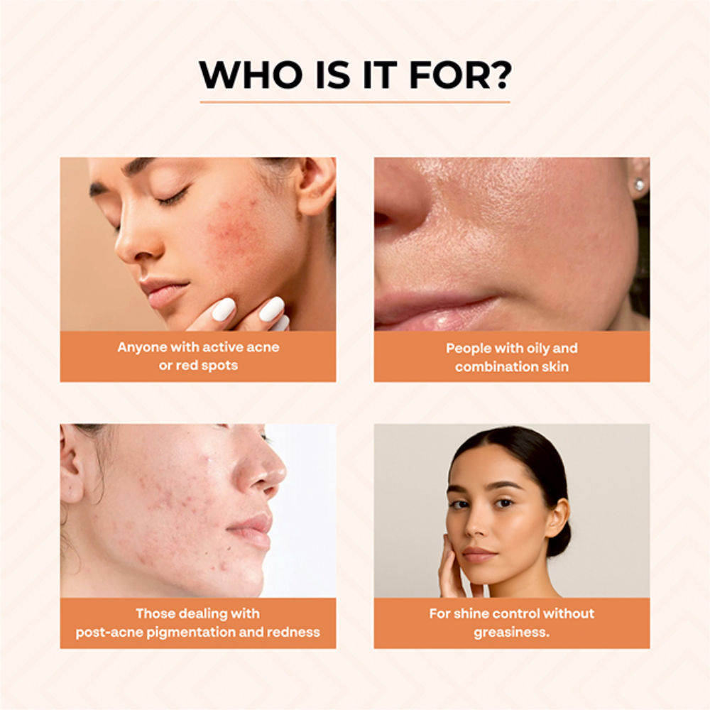 Acne & Pimple Morning Cream