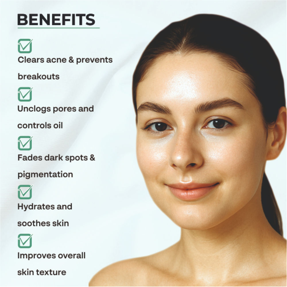 Acne & Pimple Moisturizer