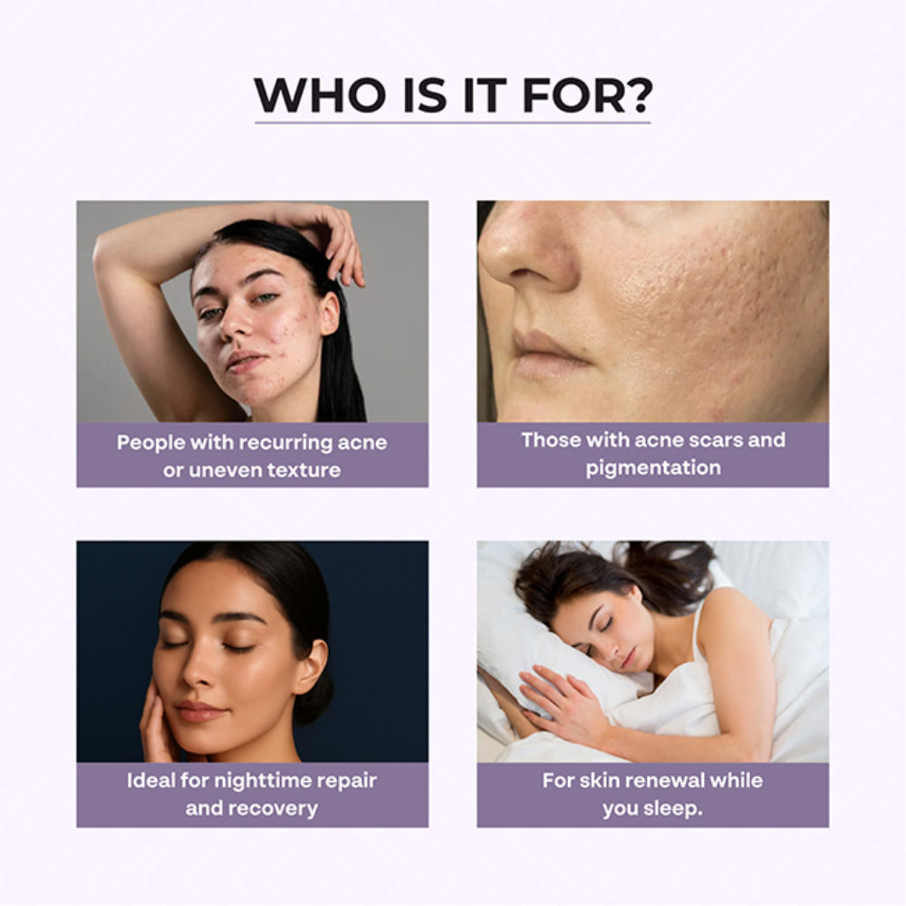 Acne & Pimple Night Cream
