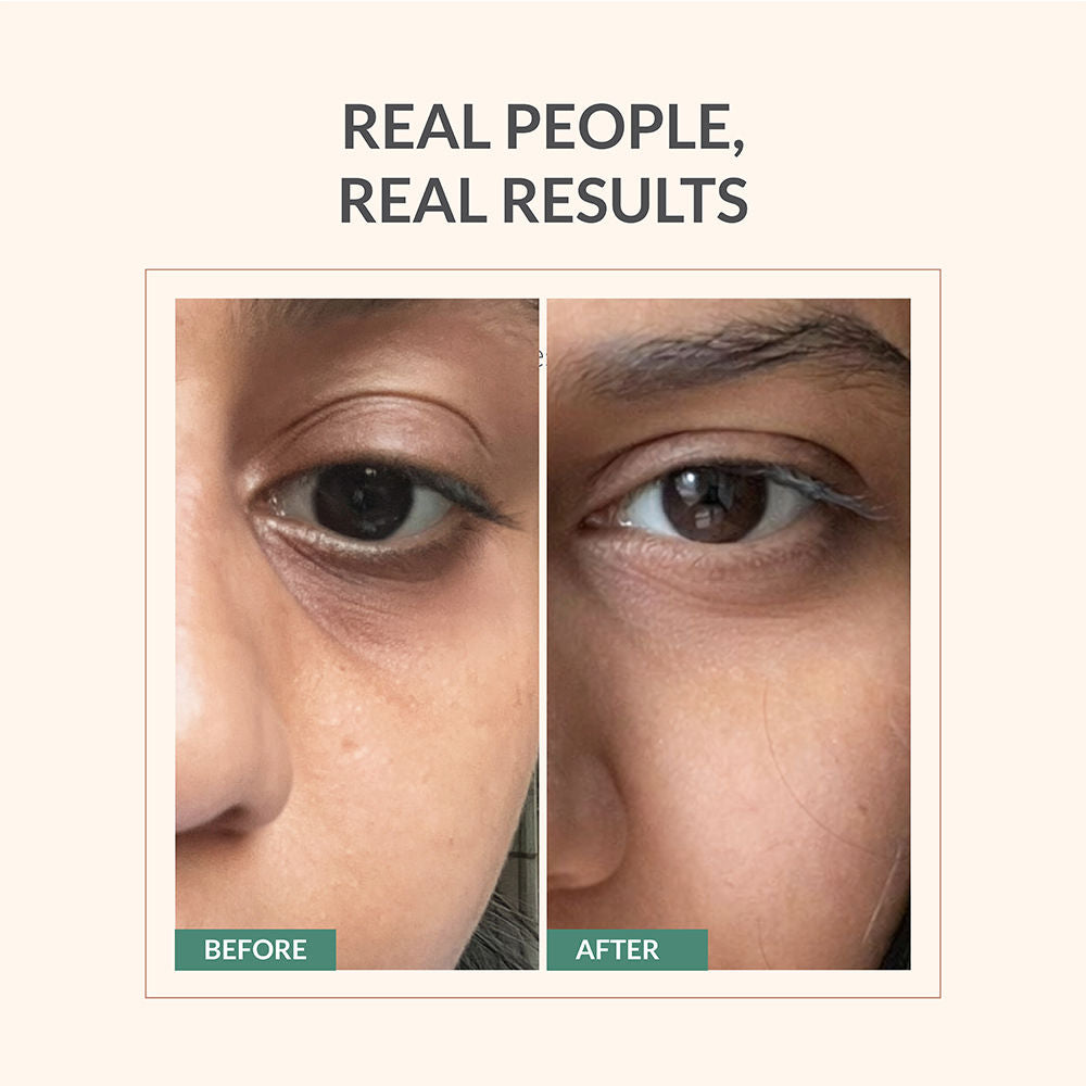 Under Eye Serum, Quinoa Seed Extract & CryoCoffee, Visibly Reduces Dark Circles, Puffiness