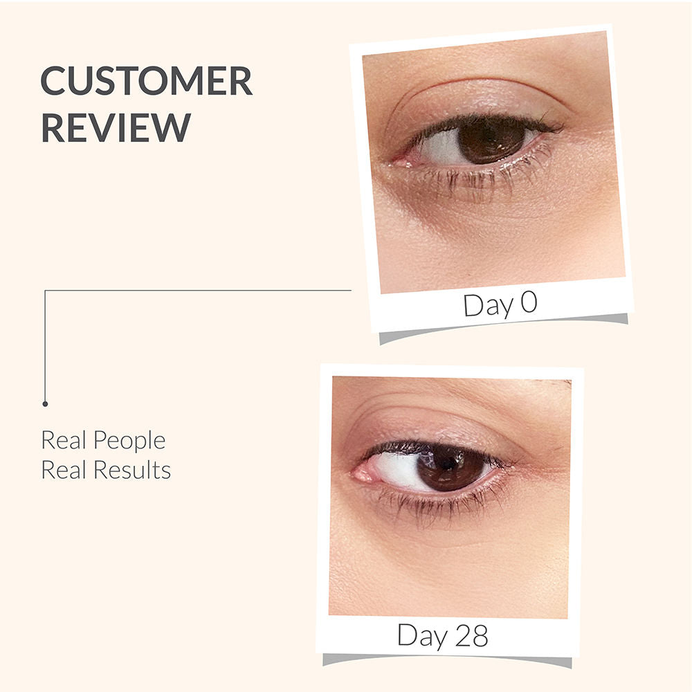 Under Eye Serum, Quinoa Seed Extract & CryoCoffee, Visibly Reduces Dark Circles, Puffiness
