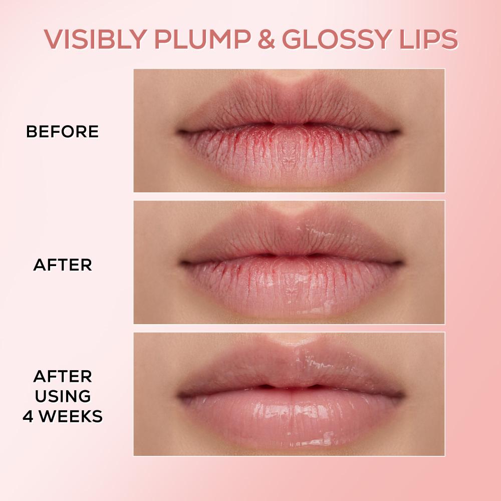 Pink Therapy PDRN Moisturizing Lip Balm