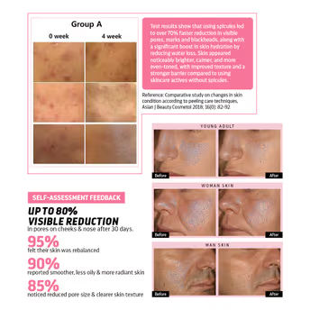 Cica Reedle Essence With PDRN