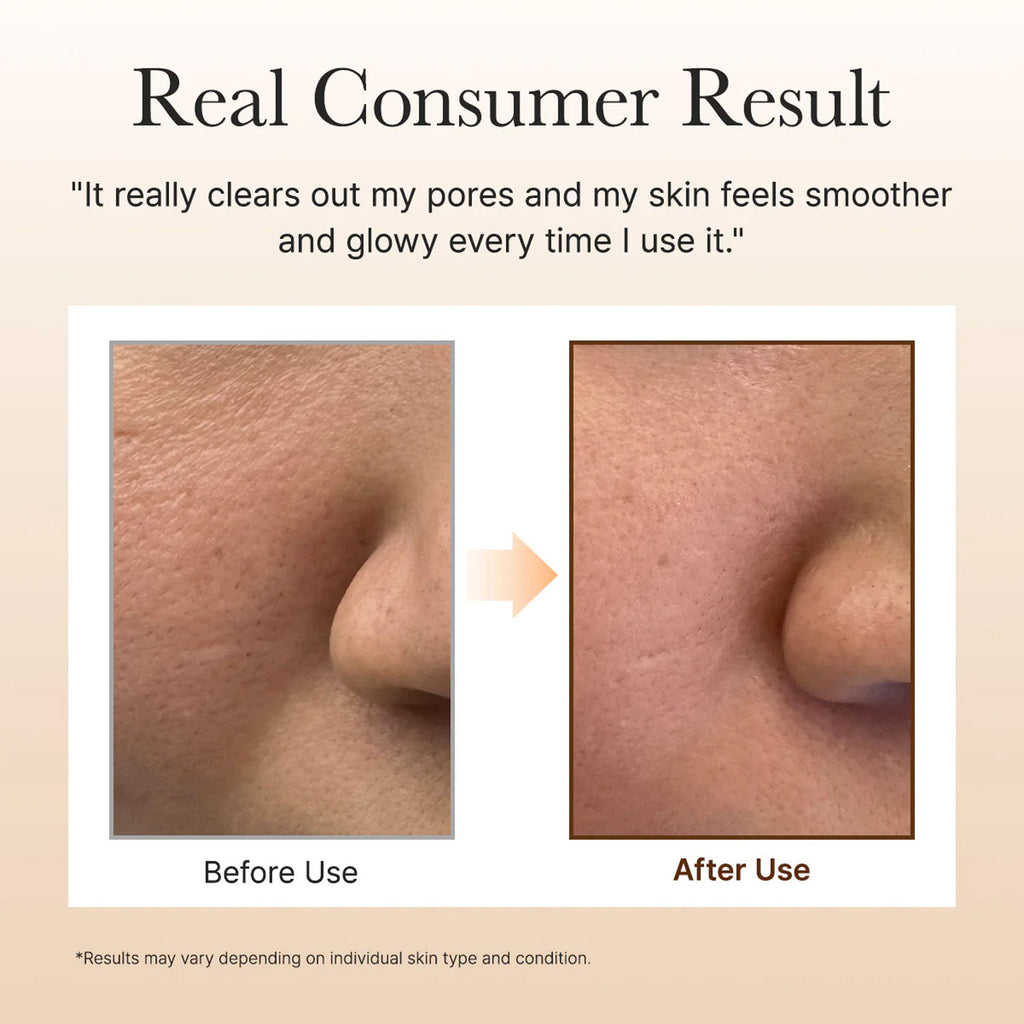 Calendula Rice Mochi Cleanser