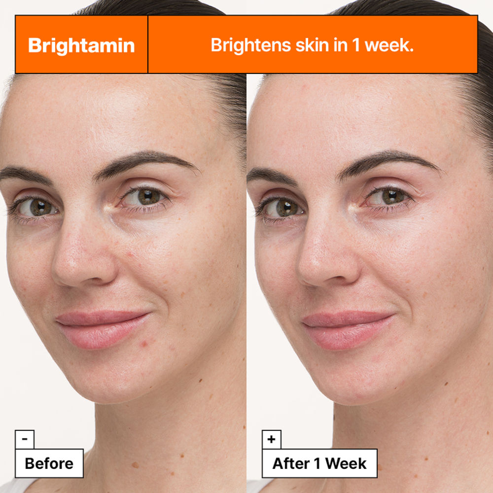 Brightamin Brightening Serum Ampoule With Vitamin C & Niacinamide