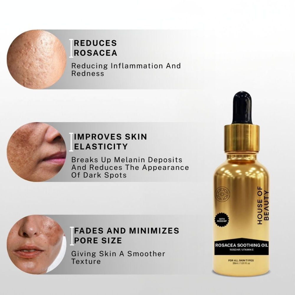 Rosacea Oil (Rosehip + Vitamin E)