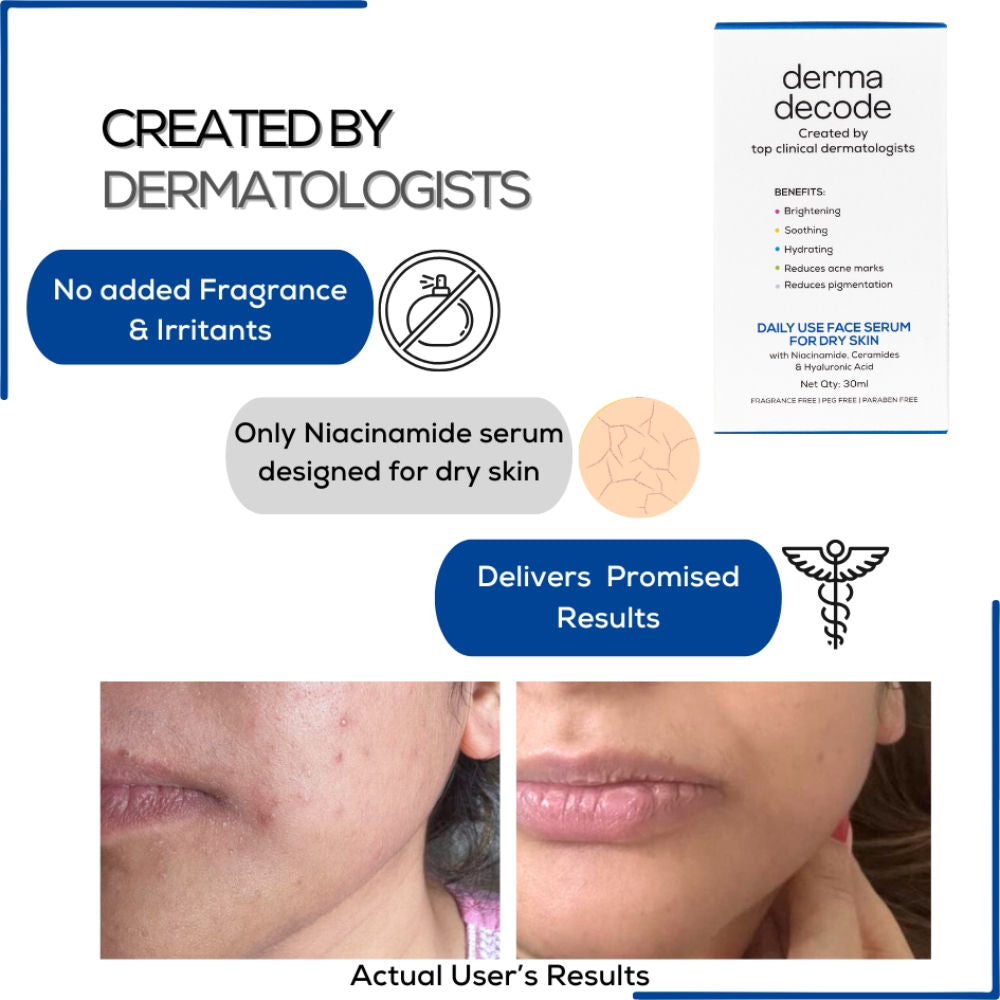 10% Niacinamide Serum Ceramide And Hyaluronic Acid Repairs Skin Barrier For Dry Skin