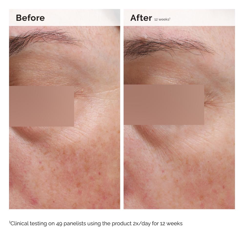 Niacinamide 5% Face & Body Emulsion