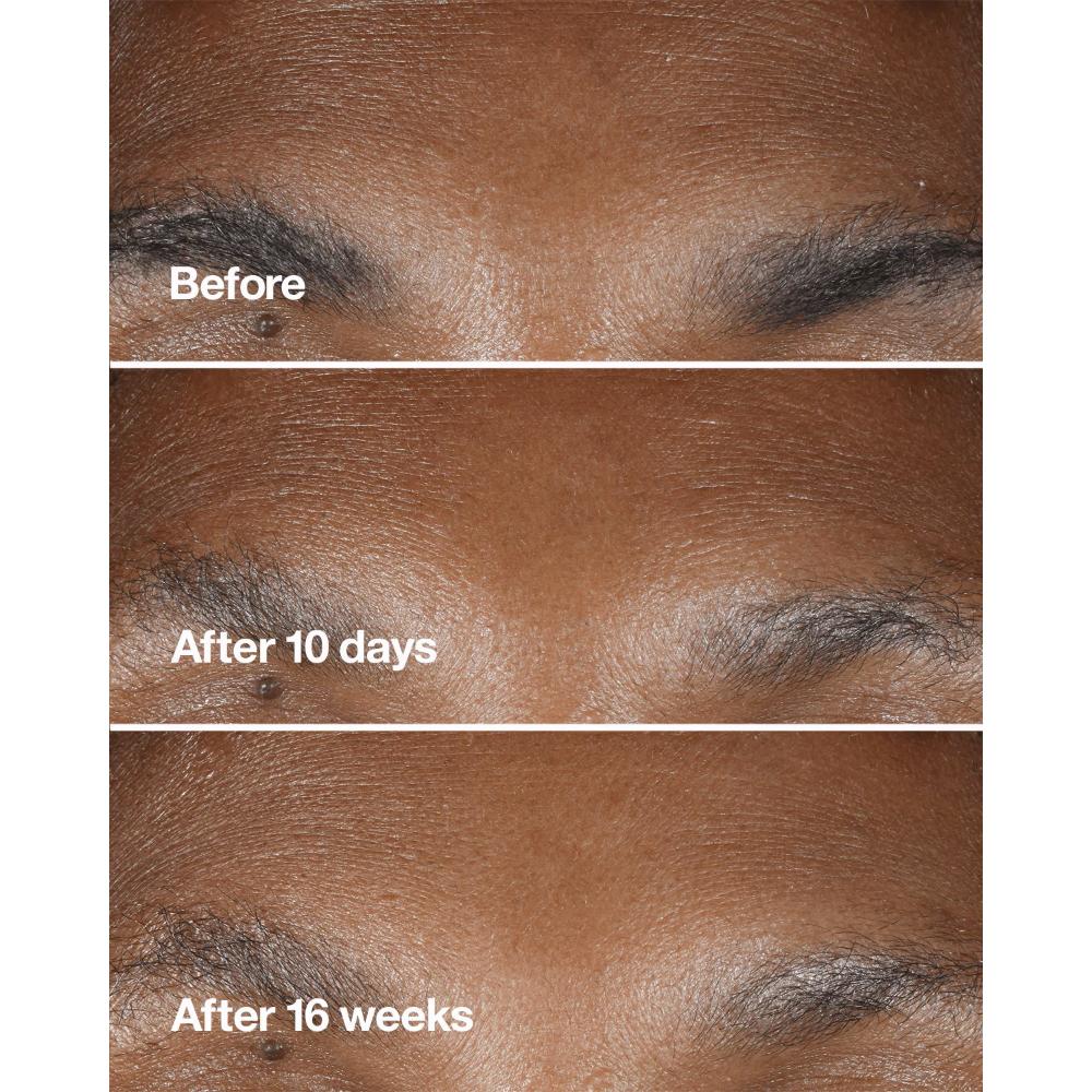 Smart Clinical Repair Wrinkle Correcting Serum