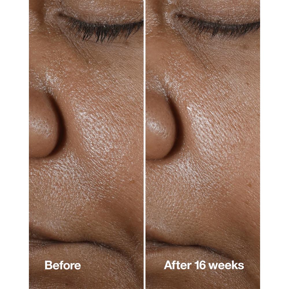Smart Clinical Repair Wrinkle Correcting Serum