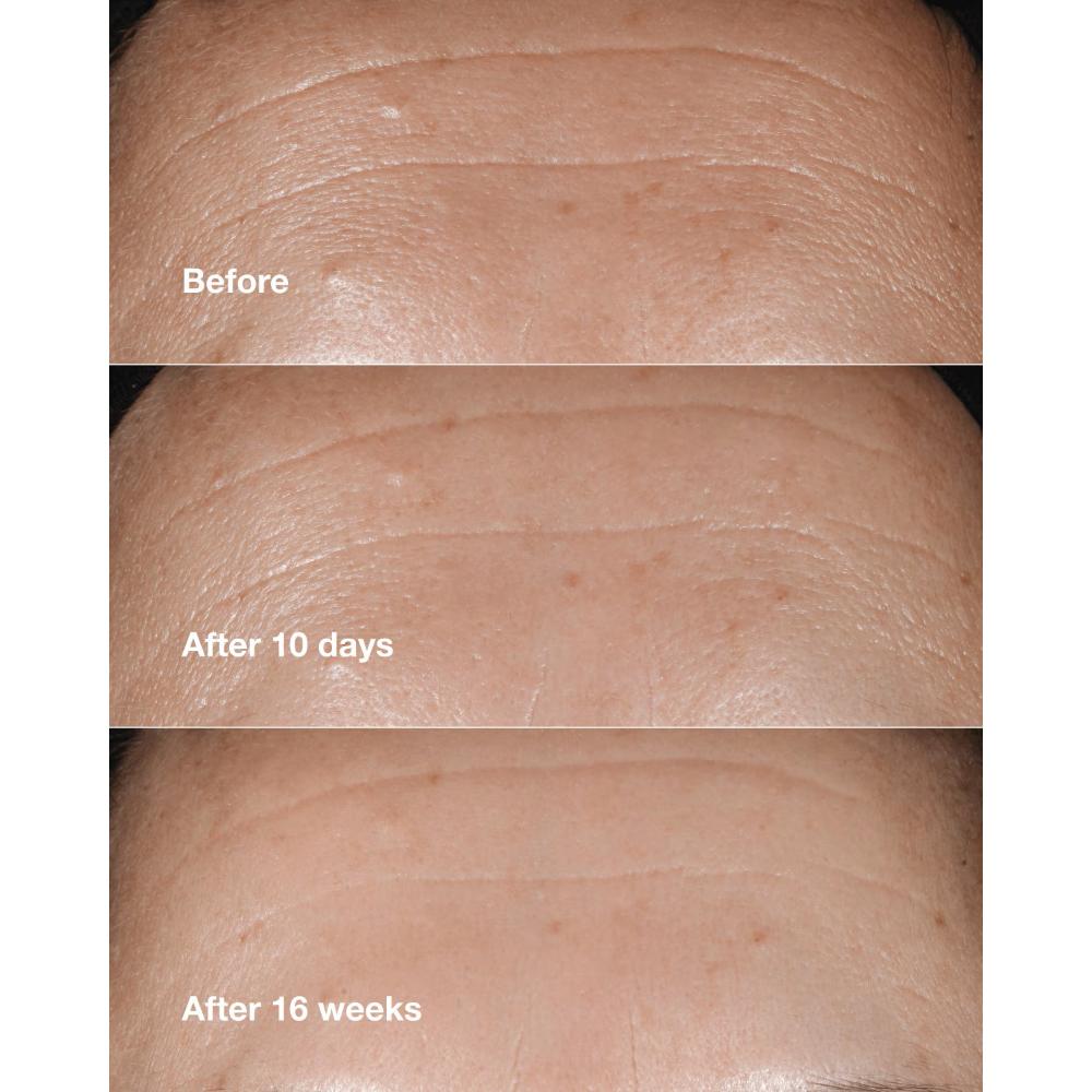 Smart Clinical Repair Wrinkle Correcting Serum