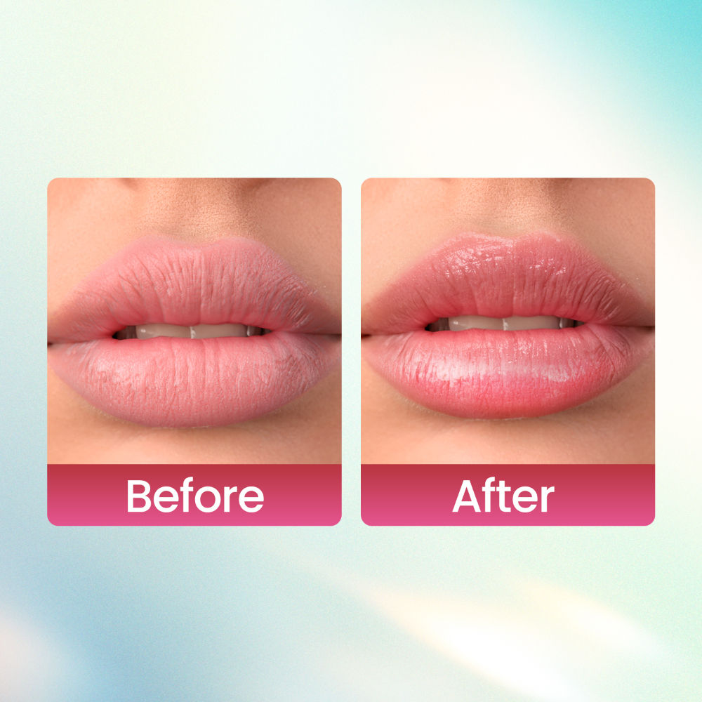 Kiss Kandy Tinted Lip Balm, Non-Sticky with Olive Oil & Vitamin E