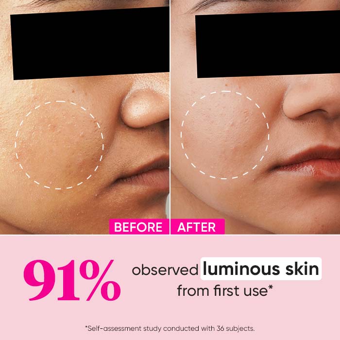 10% Glycolic Watermelon Super Glow Face Serum For Pigmentation