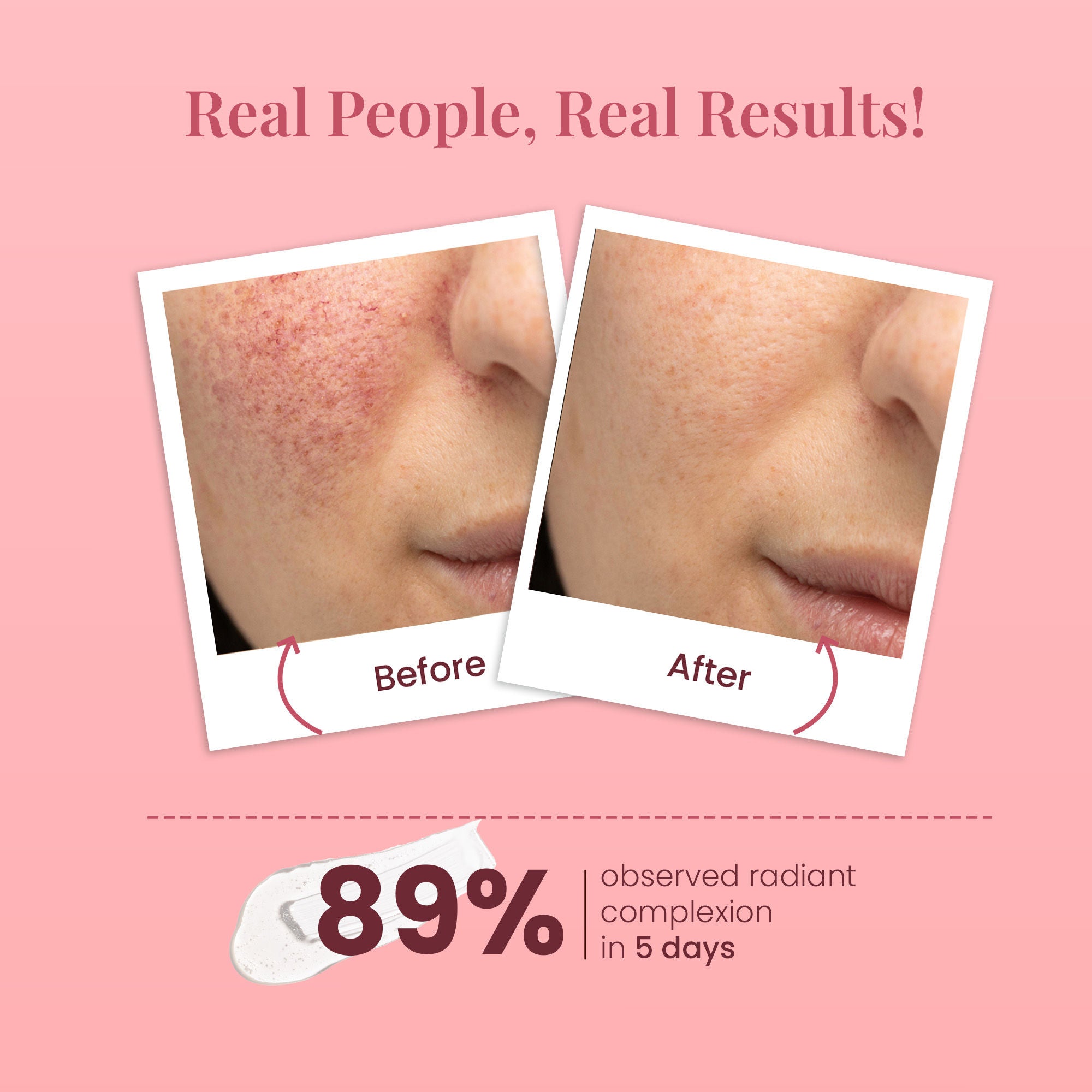 Ideal Bright Face Wash Boosts Radiance Improves Texture Reduce Pigmentation Dark Spots