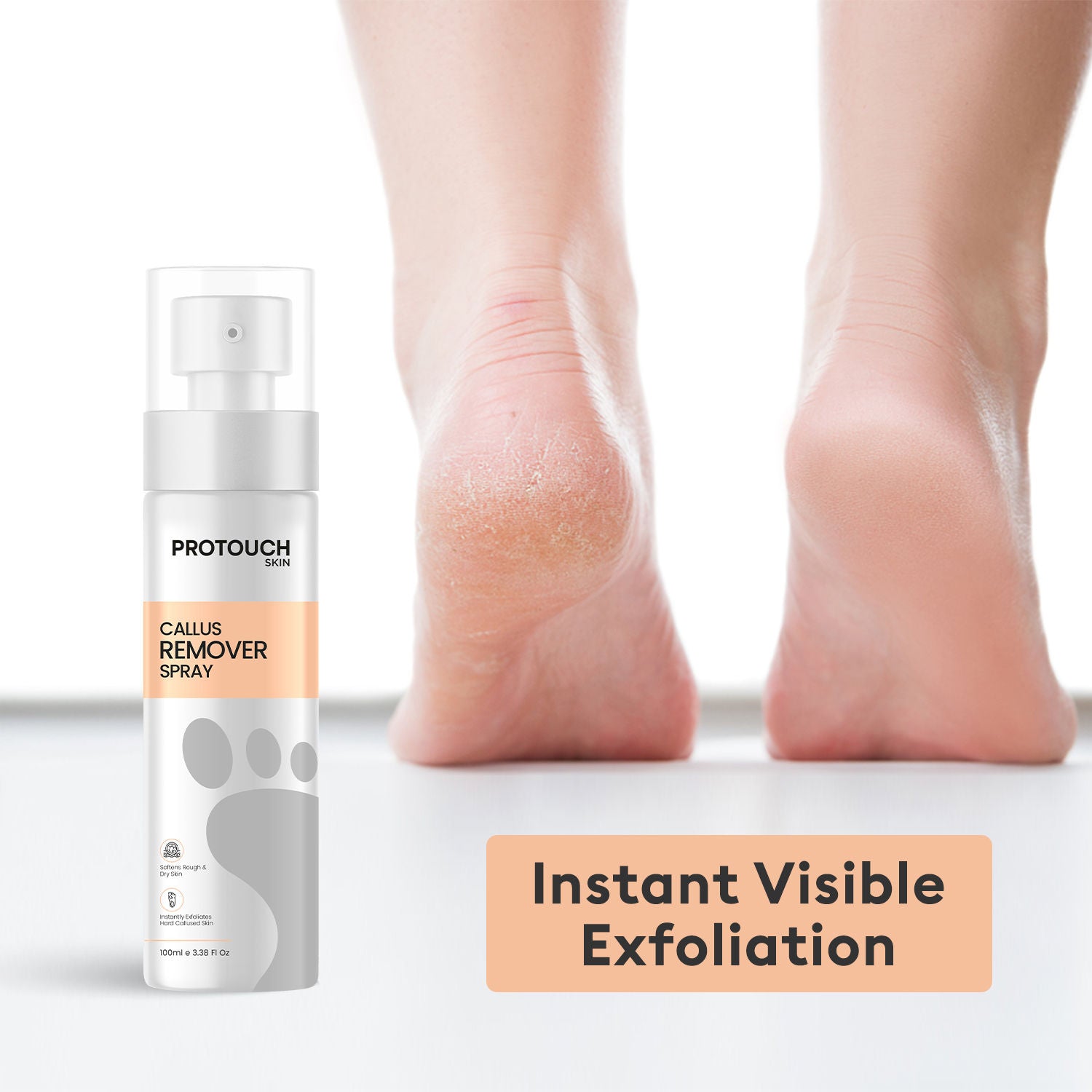Callus Remover Spray