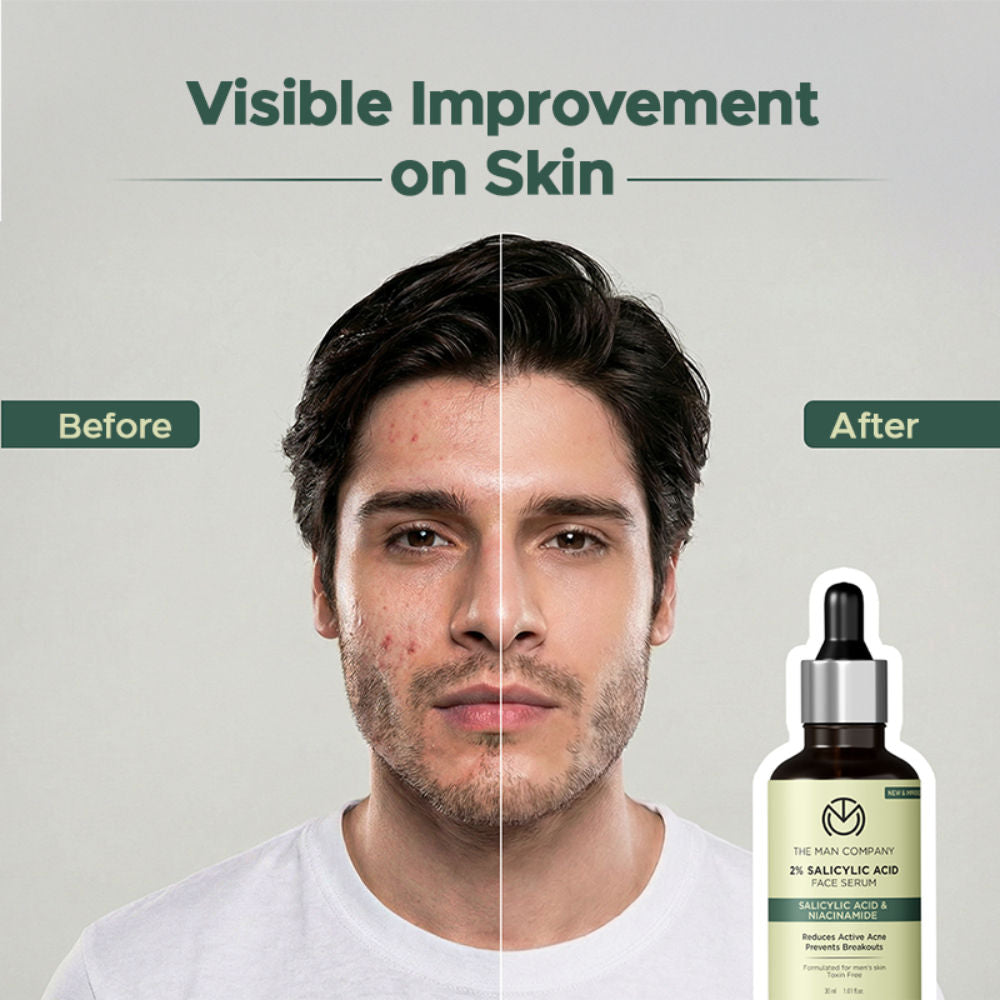 2% Salicylic Acid Face Serum