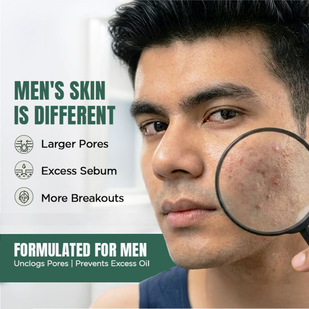 Anti Acne Face Wash