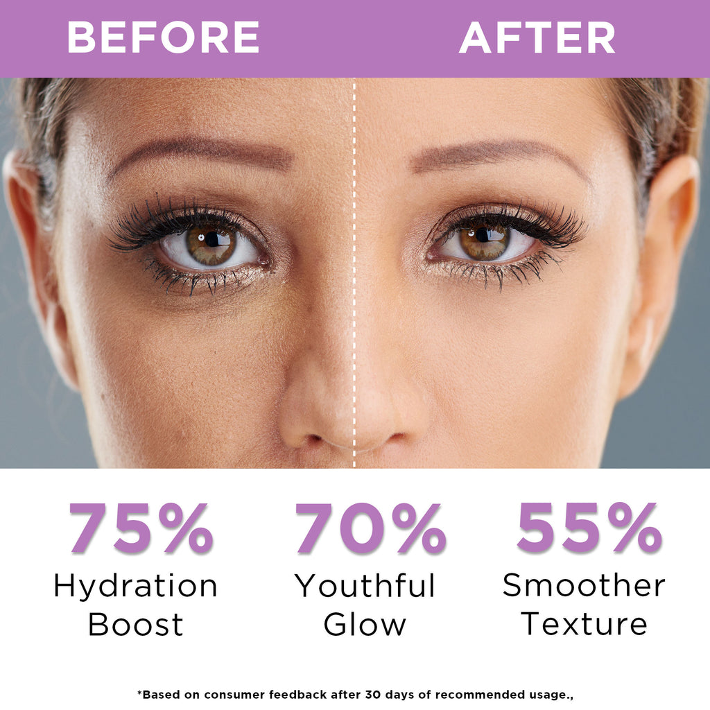 Reduces Wrinkles & Fine Lines, Anti-Aging Night Cream with Ceramide, Collagen