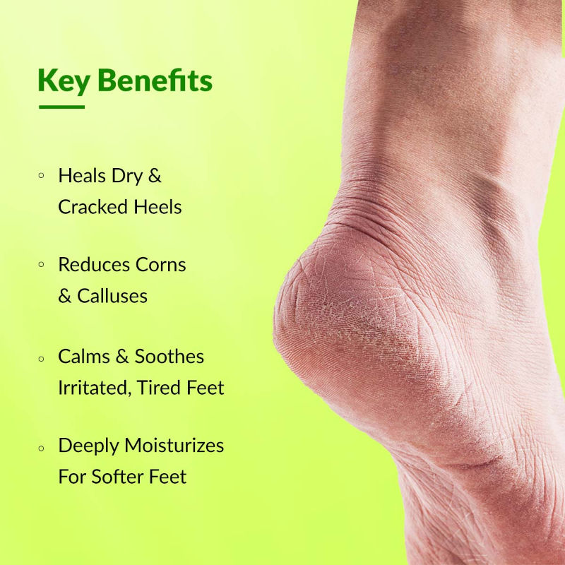 Foobetik Foot Cream with Lactic Acid & Shea Butter for Cracked Heels & Rough Feet