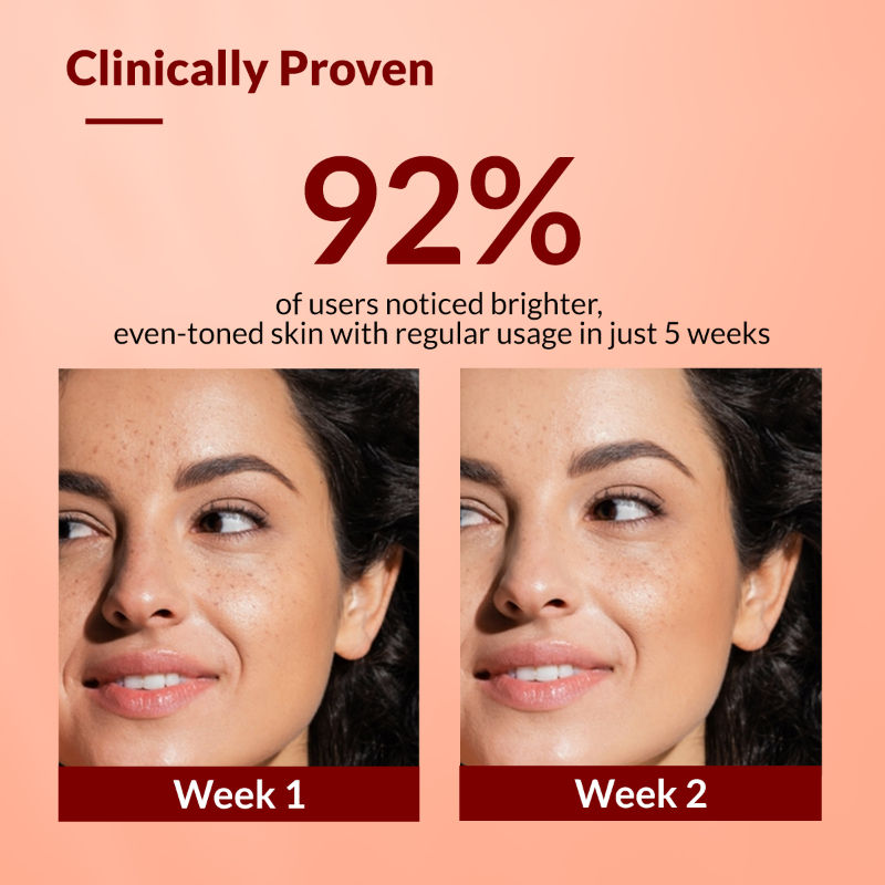Tranexamic Acid + 2%Kojic Acid + 1%Arbutin SKARFIX TX Face Cream For Pigmentation