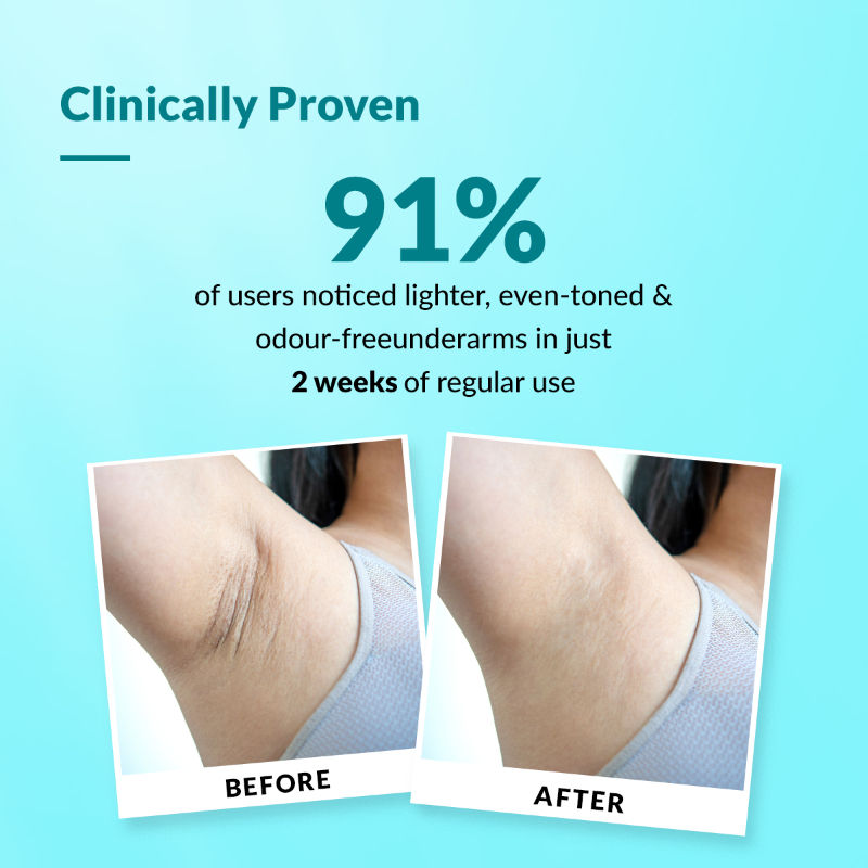 Nigrifix 6% AHA Underarm Lightening Roll On | Lactic Acid & Kojic Acid, Reduces Pigmentation & Odour for Women & Men