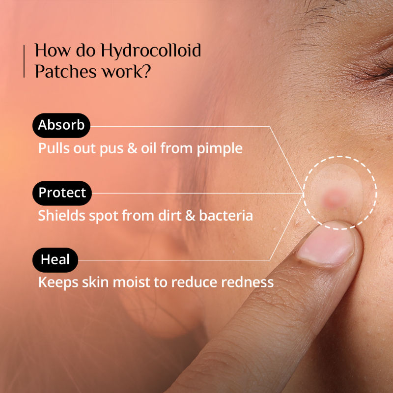 Pimple Patch for Acne, 72 Hydrocolloid and Salicylic Acid Patches, For All Skin Types