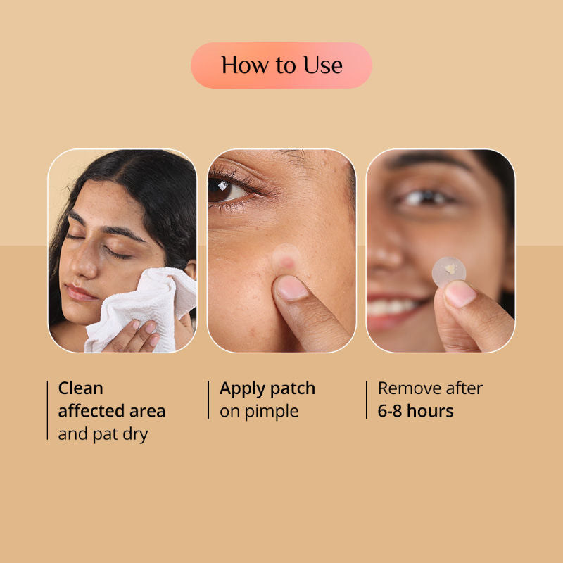 Pimple Patch for Acne, 72 Hydrocolloid and Salicylic Acid Patches, For All Skin Types