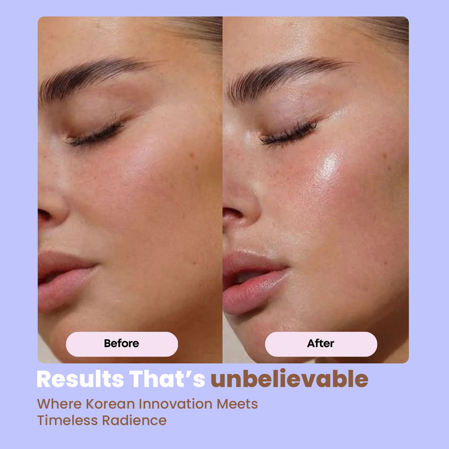 Invisible Melting Collagen Face Mask 1 Unit- 6 Patches