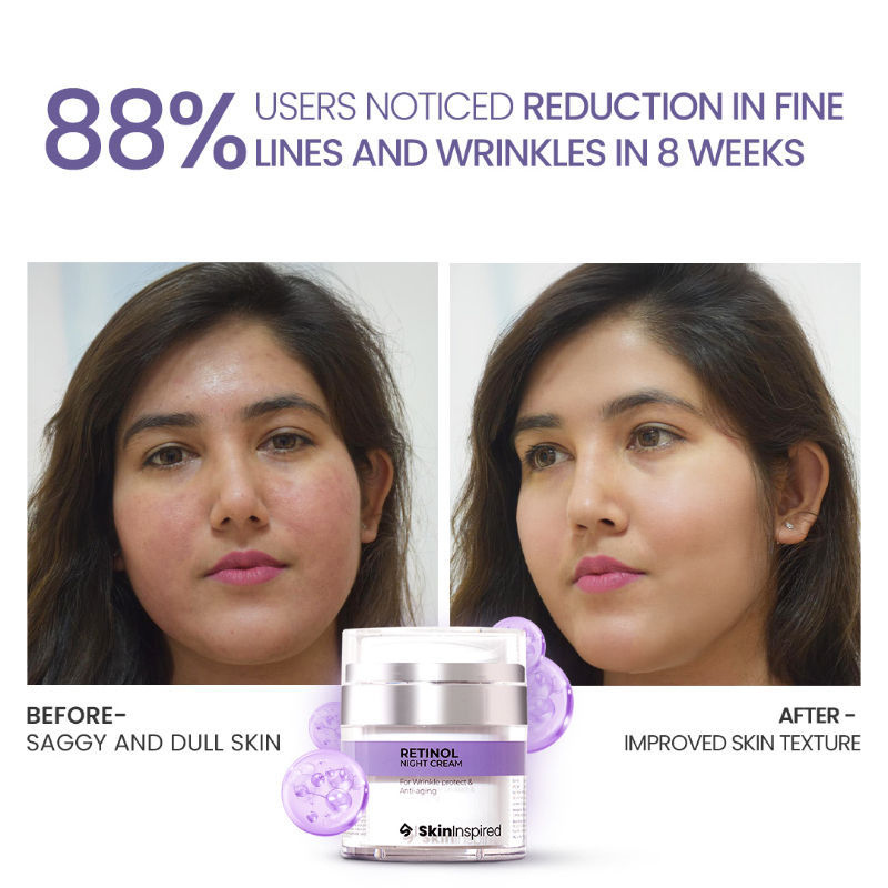 Retinol Night Cream