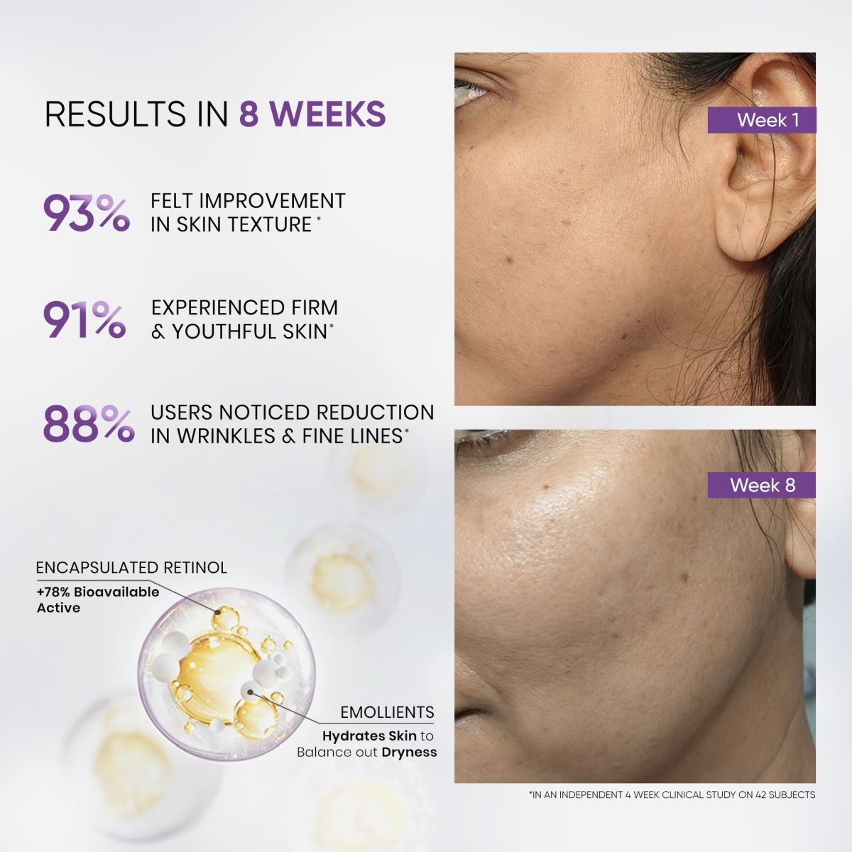 Retinol Night Cream