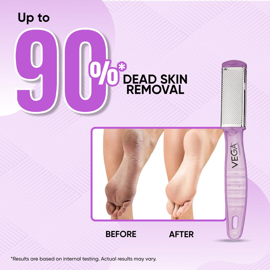 Pedicure Foot File–Dual-Sided Foot Scrubber for Remove Dead Skin, Callus (PD-03)