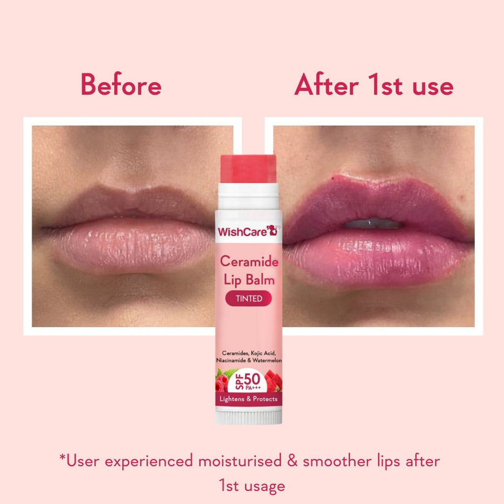 Tinted Ceramide Lip Balm for Dark Pigmented Lips with SPF50 PA+++ Heals Dry & Chapped Lips