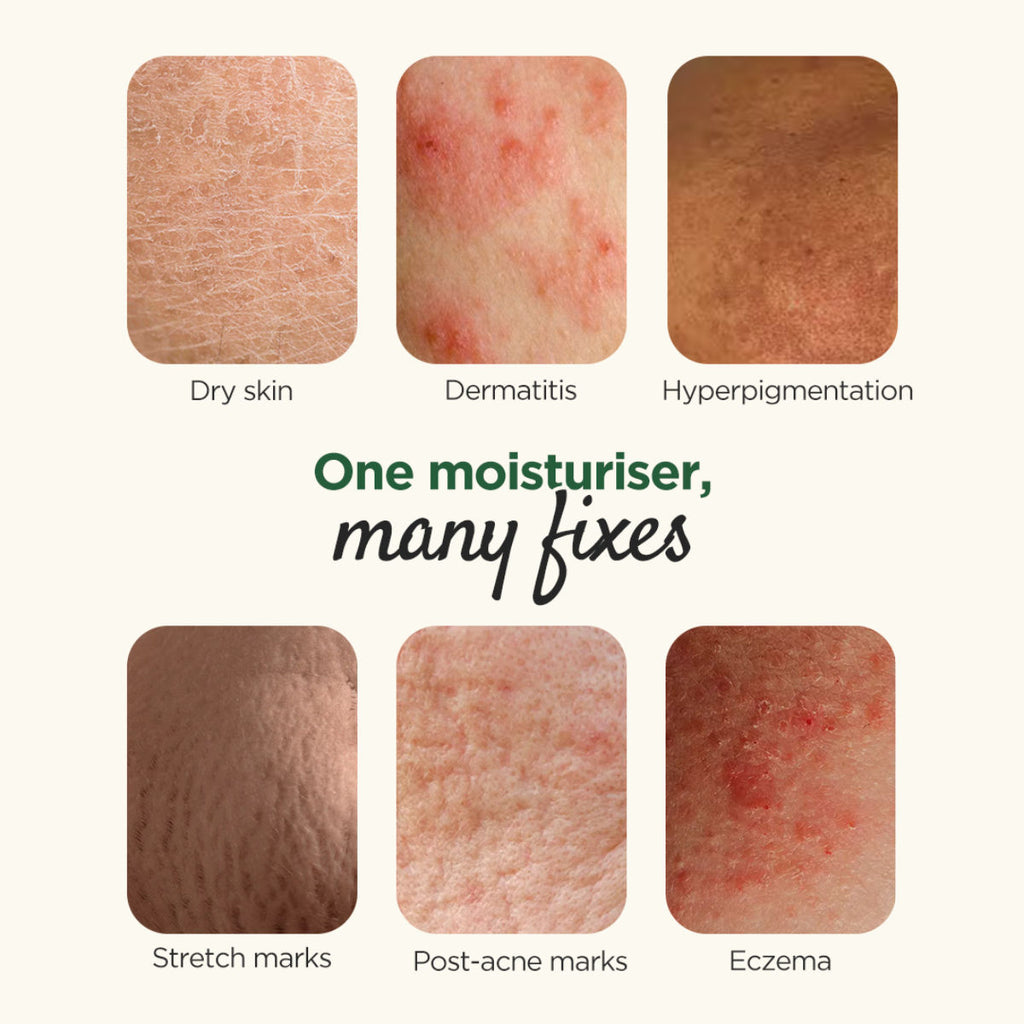 Moisturising Cream