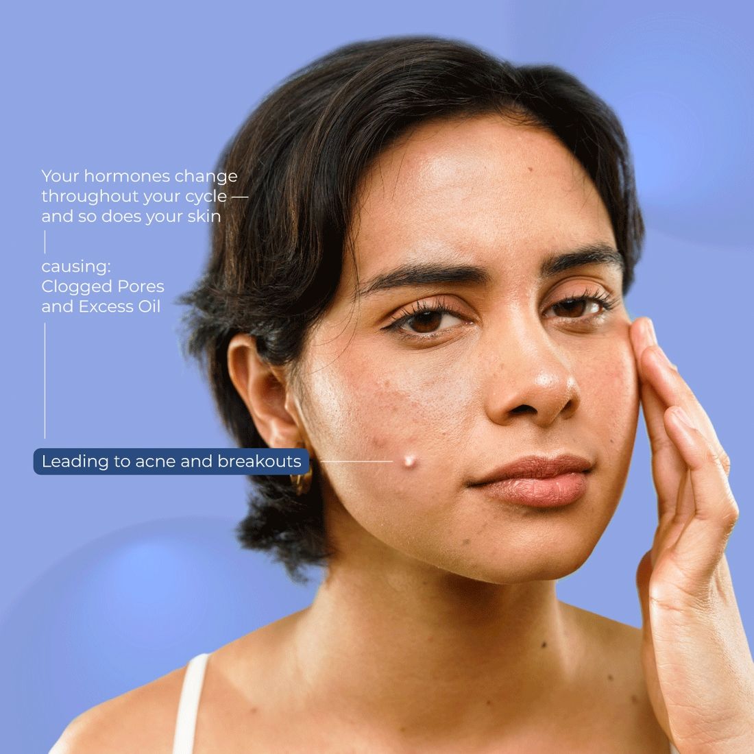 Pimple Patch for Acne - 36 Hydrocolloid and Salicylic Acid Patches - For All Skin Types