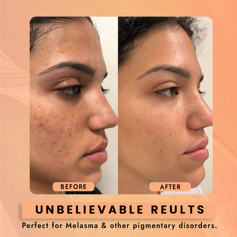2% Kojic Acid Face Serum for Dark Spots, Skin Brightening & Radiant Glow