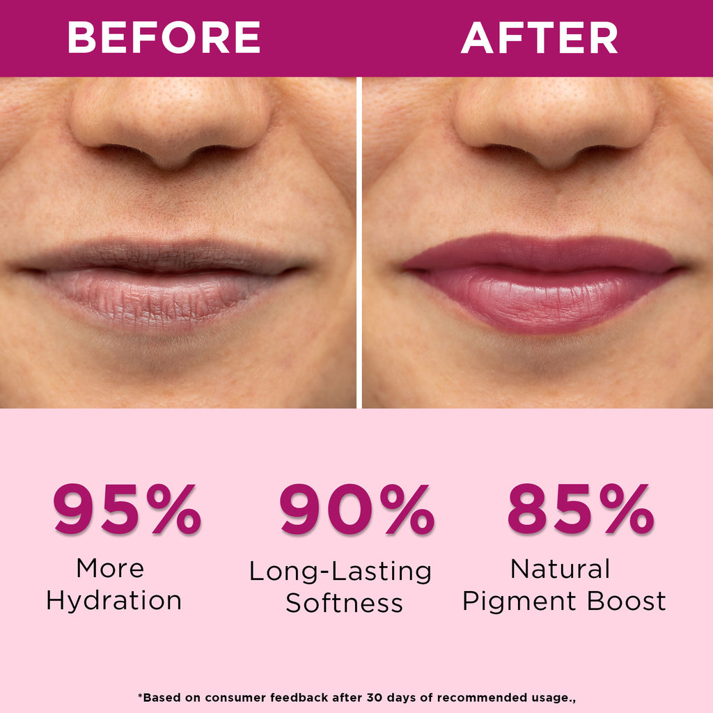 Beetroot Tinted Lip Balm SPF 30 PA++ with Ceramide & Kojic Acid for Brighten Dark Lips