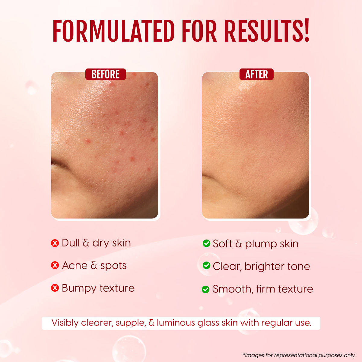 Rice Ceramide Serum Barrier Repair With Niacinamide & Ha For Skin Brightening, Acne Spots