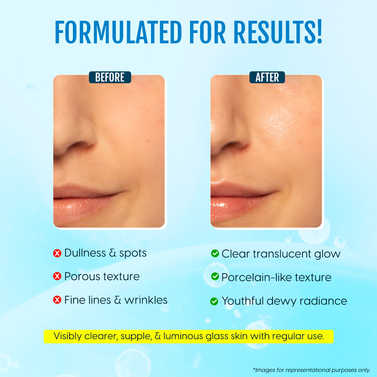 Korean Glass Skin Serum With Salicylic Acid & Lactic Acid For Spotless Glow & Anti Aging