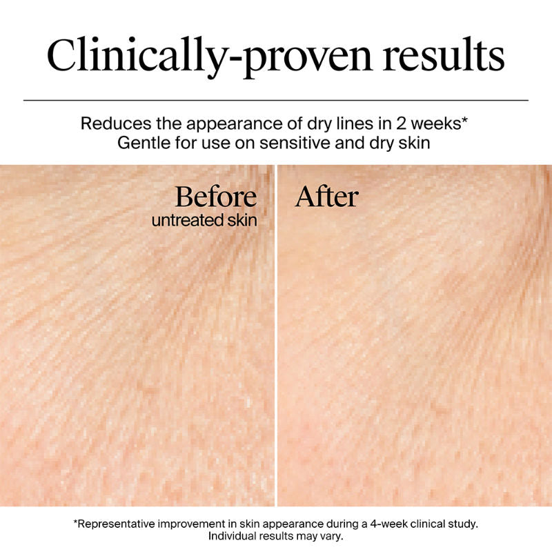 Hydro Boost Nourishing Cream Moisturizer with Hyaluronic Acid + Ceramides For Dry Skin