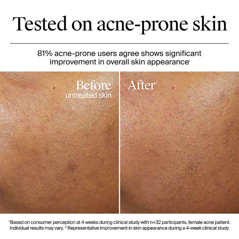 Hydro Boost Nourishing Cream Moisturizer with Hyaluronic Acid + Ceramides For Dry Skin