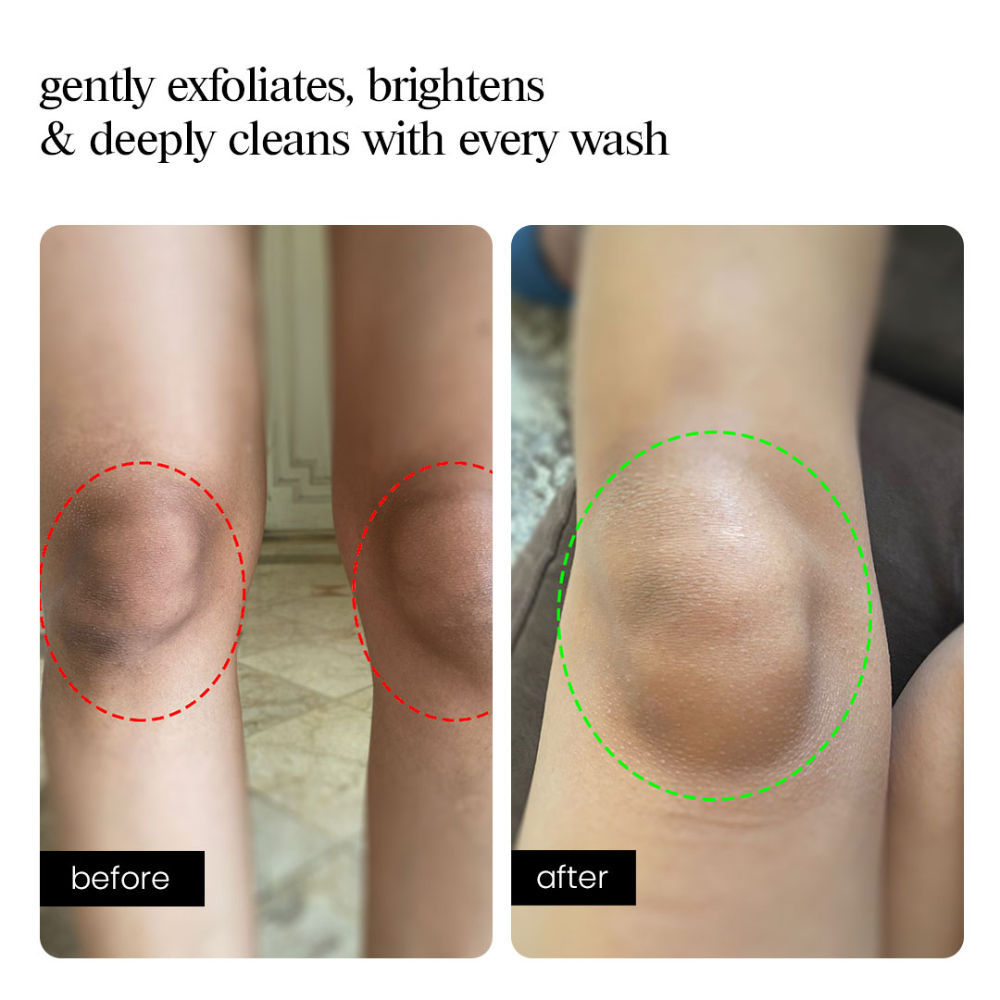 AHA Body Wash – Exfoliating Cleanser for Brighter, Smoother Skin, 5 AHAs + Charcoal Detox