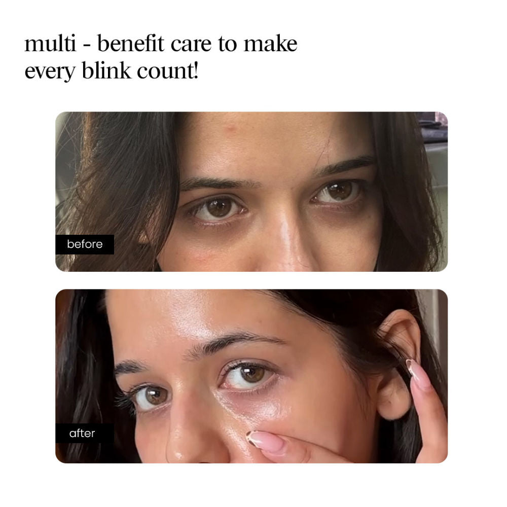 Eye Serum – Peptide, Caffeine, HA + 15 Actives for Dark Circles, Puffiness, Wrinkles, Fine Lines